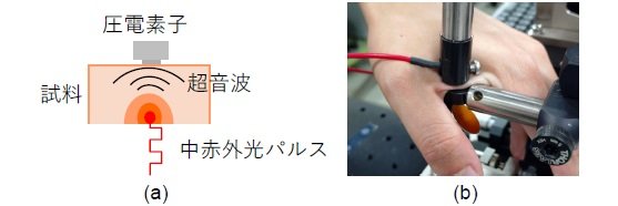 非侵襲で血液成分の分析が可能な新技術を開発