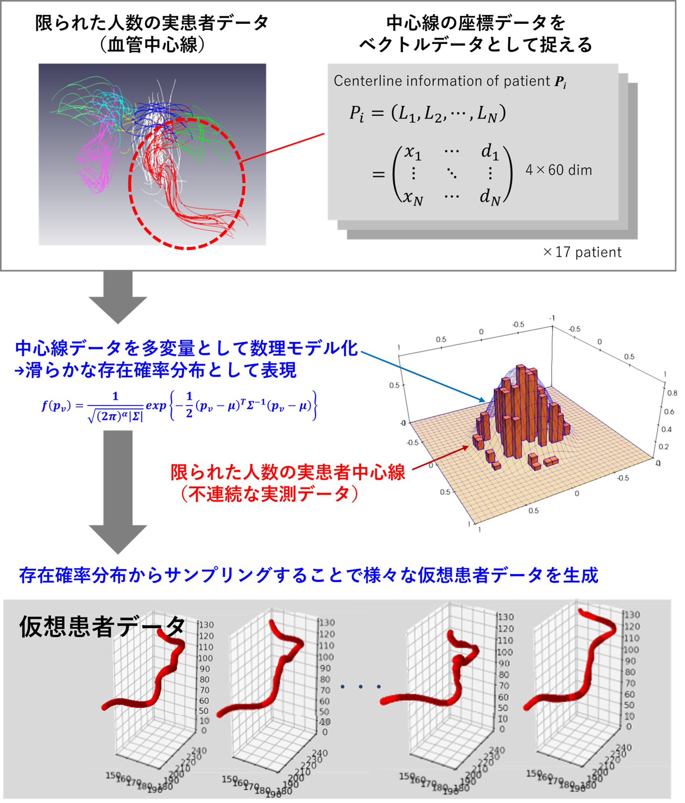 脳動脈形状の「仮想集団」モデルを開発