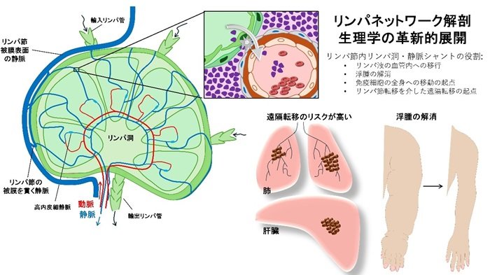 がん転移とリンパ浮腫の根治につながる新発見
